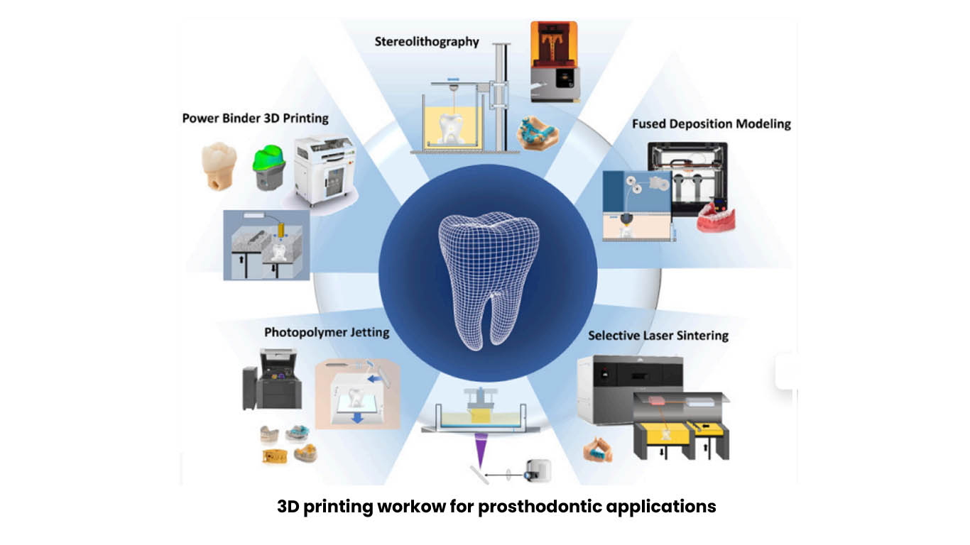 Comprehensive Management of PeriImplantitis