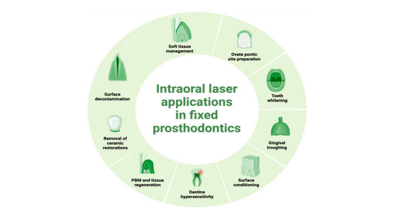 Comprehensive Management of PeriImplantitis